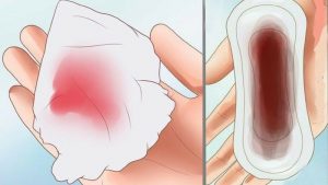 Xuất huyết âm đạo