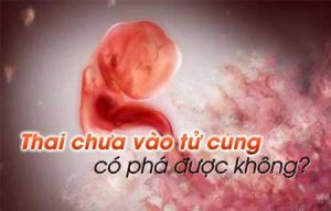 Thai chưa vào tử cung có phá được không