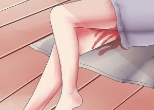 Chảy máu âm đạo