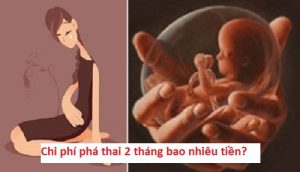 Chi phí phá thai 2 tháng tuổi