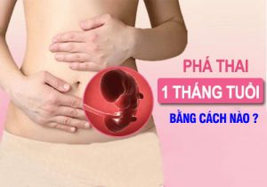 Phá thai 1 tháng tuổi bằng cách nào