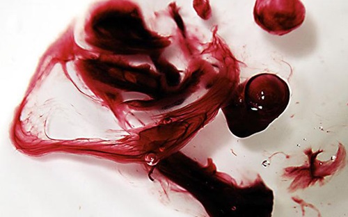 Uống thuốc phá thai viên đầu tiên ra máu cục