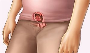 Thai 3 tuần có uống thuốc phá thai được không