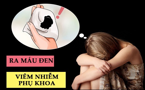 Uống thuốc phá thai ra máu đen